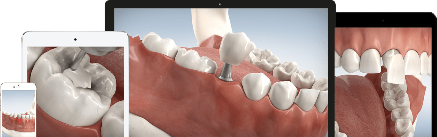 Smile-3D Animationen